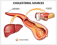 art-cholesterol